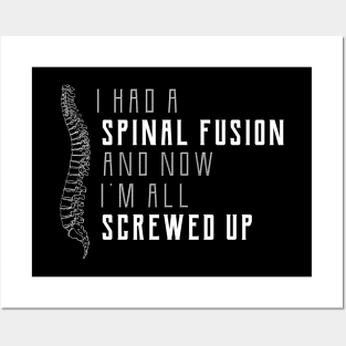 Spine Surgery - I had a spinal fusion and now I'm all screwed up Posters and Art